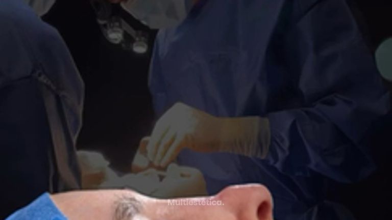 Uno de los casos más complicados de 2025, Rinoplastia Cuaternaria (4ta).