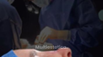 Uno de los casos más complicados de 2025, Rinoplastia Cuaternaria (4ta).