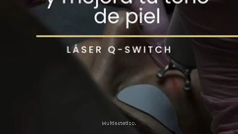 Láser Q-Switch