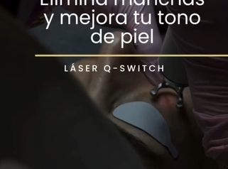 Láser Q-Switch