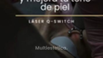 Láser Q-Switch