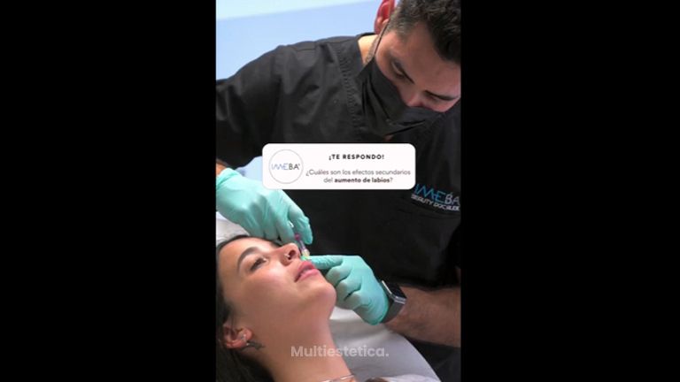 Aumento de labios - Clinicas IMEBA®