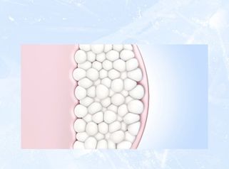 ¿Cómo funciona CoolSculpting? - Porcuna&DeBenito
