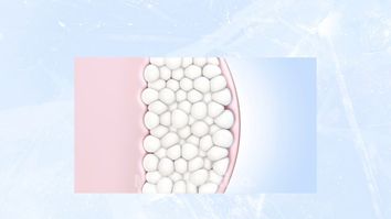 ¿Cómo funciona CoolSculpting? - Porcuna&DeBenito