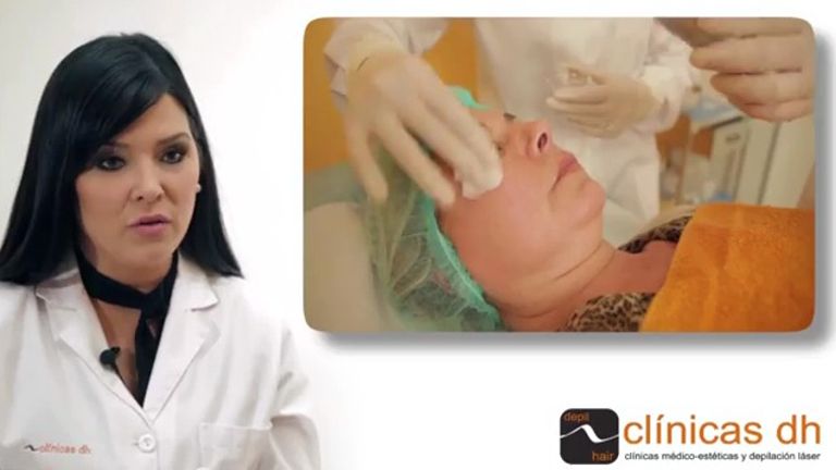 Peeling médico químico