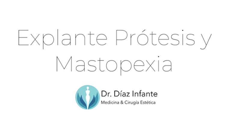 Explante Prótesis y Mastopexia - Dr. José Luis Díaz Infante