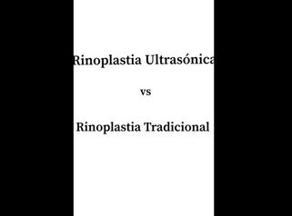 Rinoplastia ultrasónica vs rinoplastia tradicional - Dr. Ibrahim Fakih