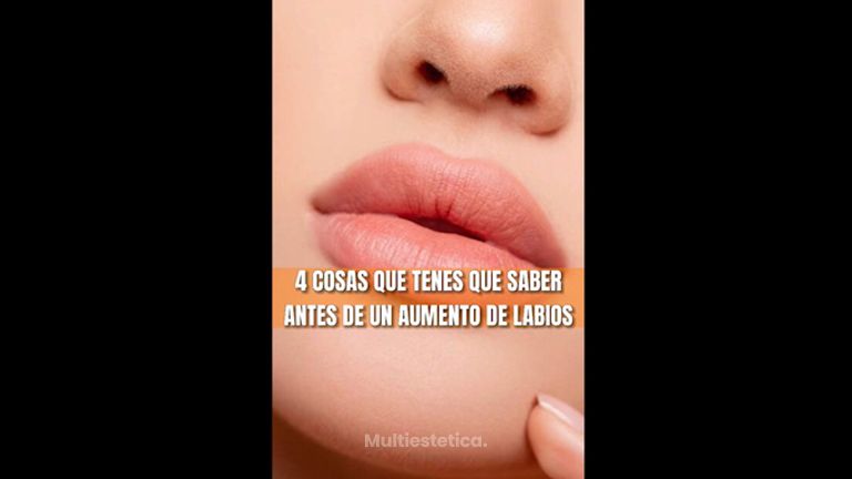 Aumento de Labios - Imebelle