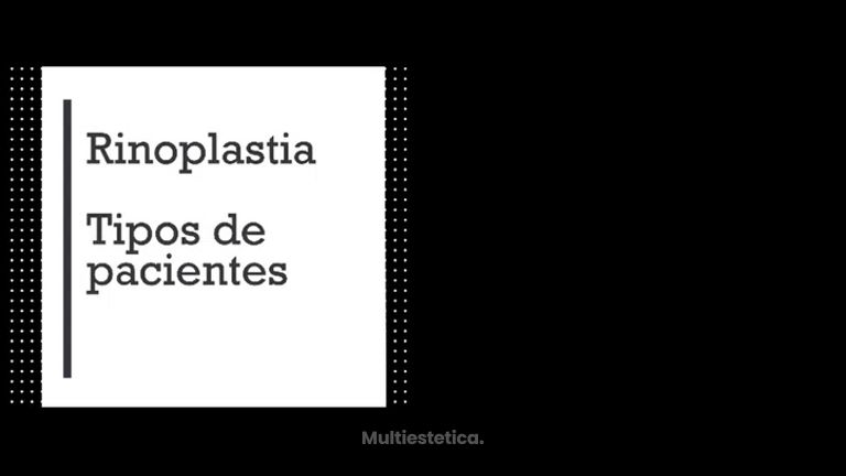 Concepto: Rinoplastia