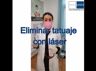 Eliminar tatuajes - Clínica Sanza