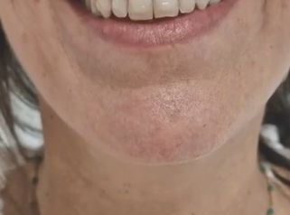 Dental Clínica Montecarmelo