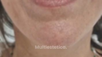 Dental Clínica Montecarmelo