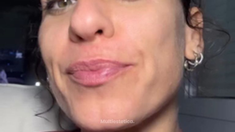 Semen de salmón! 🍣 Nuevo tratamiento en la @clinica_dra.villafane