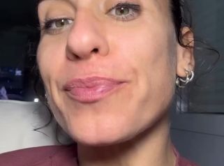 Semen de salmón! 🍣 Nuevo tratamiento en la @clinica_dra.villafane