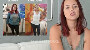 Testimonio bypass gástrico