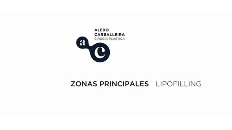 Lipofilling por Dr. Alexo Carballeira
