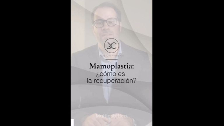 Recuperación en Aumento de Pecho - Dr. Jose Casarrubios