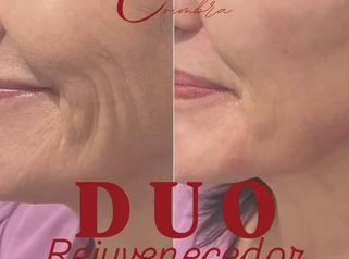 ✨ DÚO REJUVENECEDOR✨