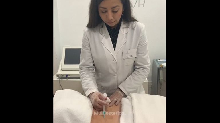 Clínica Dra. Any Ramírez - Mesoterapia