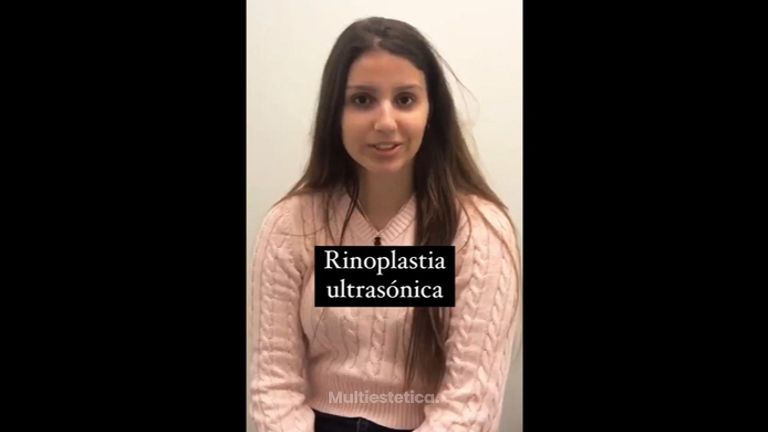 Testimonio Rinoplastia ultrasónica - Clínica Rinos