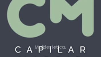 ¿Te quieres hacer un transplante capilar?