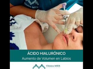 Ácido hialurónico - Clínica MER