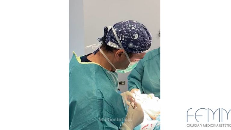 Blefaroplastia con el Dr. Ramón Calderón