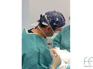 Blefaroplastia con el Dr. Ramón Calderón
