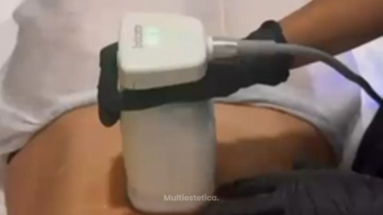 ELIMINAMOS LA GRASA LOCALIZADA