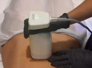 ELIMINAMOS LA GRASA LOCALIZADA