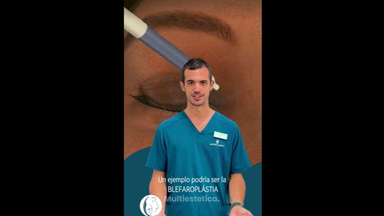 Blefaroplastia - Clínica Image