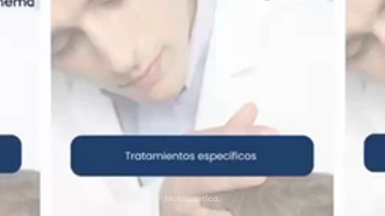 Tras un Trasplante Capilar, el seguimiento es clave para obtener los mejores resultados posibles.