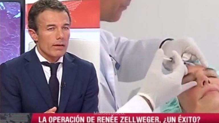 Lo que necesitas saber sobre la cirugía plástica