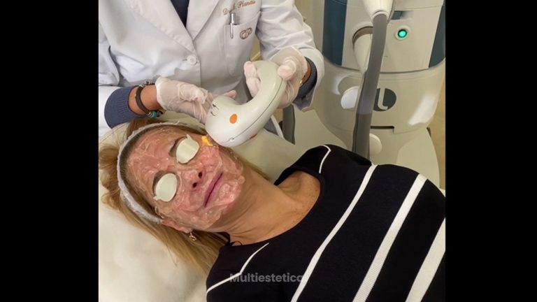 Tratamiento láser facial - Clínica Planas