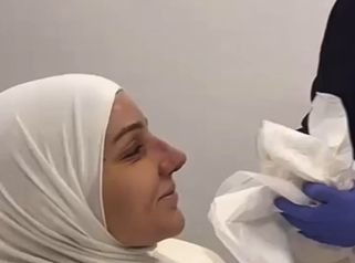 Rinoplastia