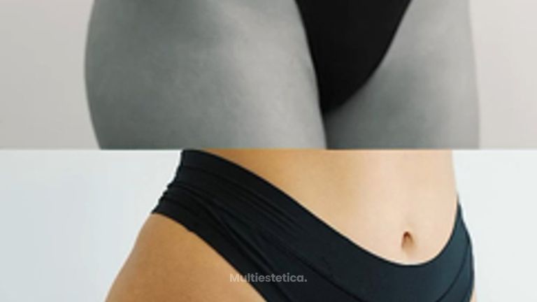 Quieres lucir unos glúteos perfectos este verano La Dra Sinclair es experta en este tratamiento