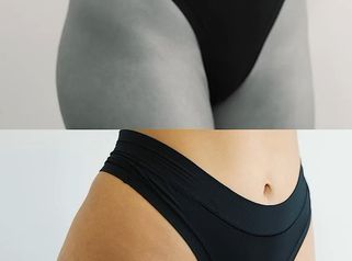 Quieres lucir unos glúteos perfectos este verano La Dra Sinclair es experta en este tratamiento