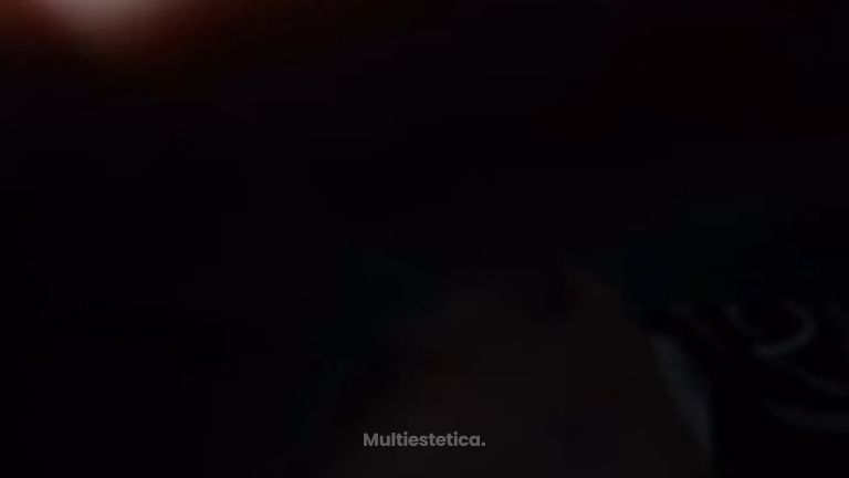 Caso de Rinoplastia Ultrasónica