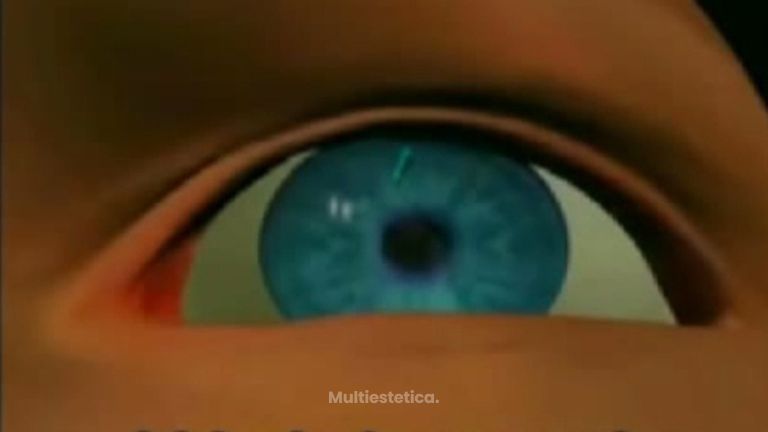 Acaba con el glaucoma gracias a la tecnología láser