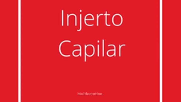 Testimonio de injerto capilar