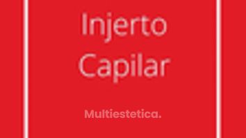 Testimonio de injerto capilar