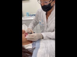 Aumento de labios - Dra. Marta Payá