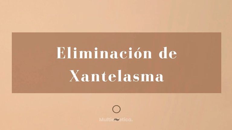 Xantelasma - Clínica Graziella Moraes