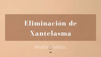 Xantelasma - Clínica Graziella Moraes