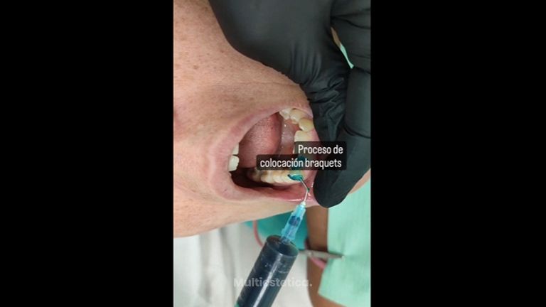 Ortodoncia - Clínica Alphadent