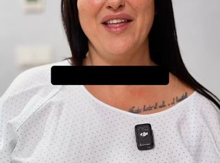 Acompañamos a Carmen a su lipotransferencia