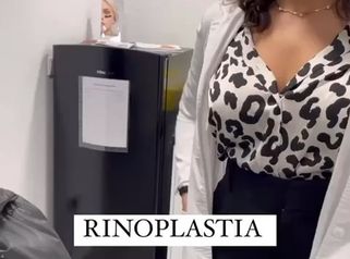 Rinoplastia - Clínicas Aura