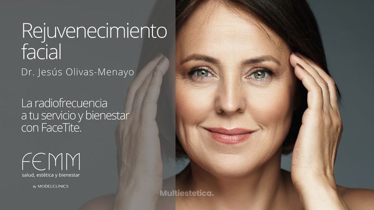 Rejuvenecimiento facial con FaceTite