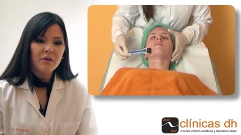 Dermaroller facial