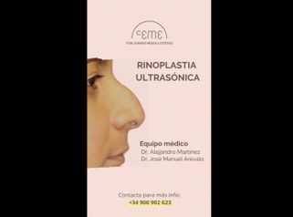 Rinoplastia - Centro CEME